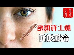 額頭有疤痕 面相